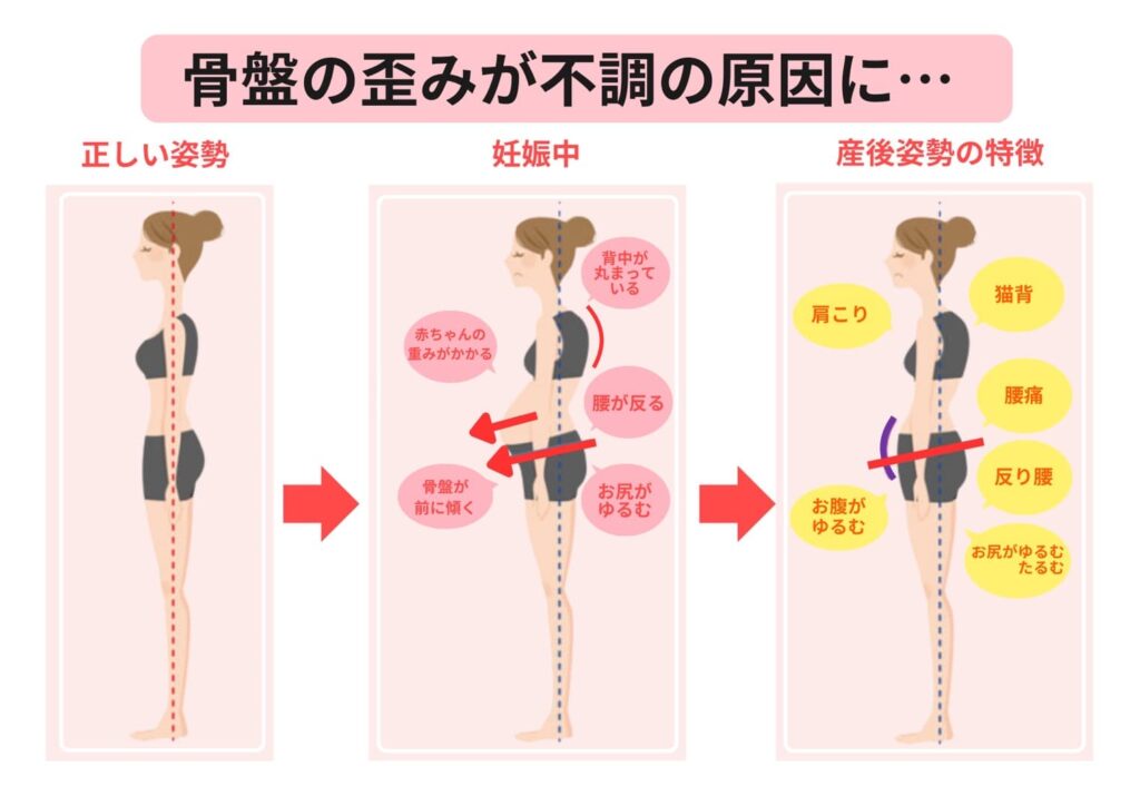 骨盤の歪みが不調の原因に...