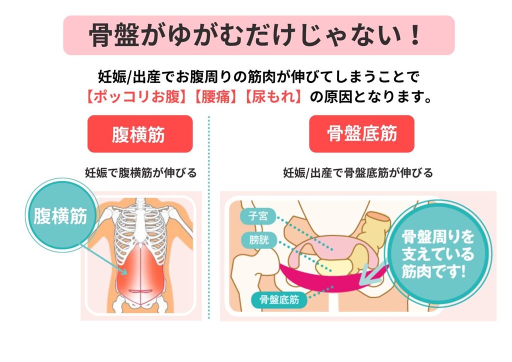 骨盤がゆがむだけじゃない！