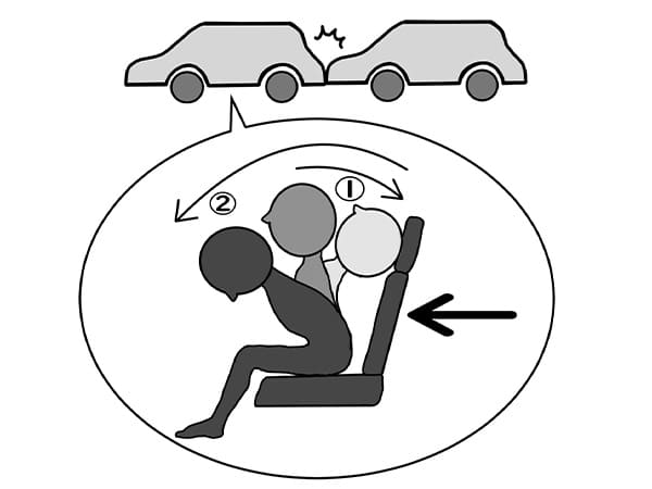 交通事故によるむち打ちのイラスト