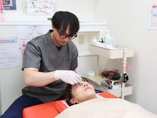 美容鍼の施術